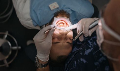 Zahnarzt kontrolliert die Zähne eines Patienten – Untersuchung bei Bruxismus und Harmonieschiene